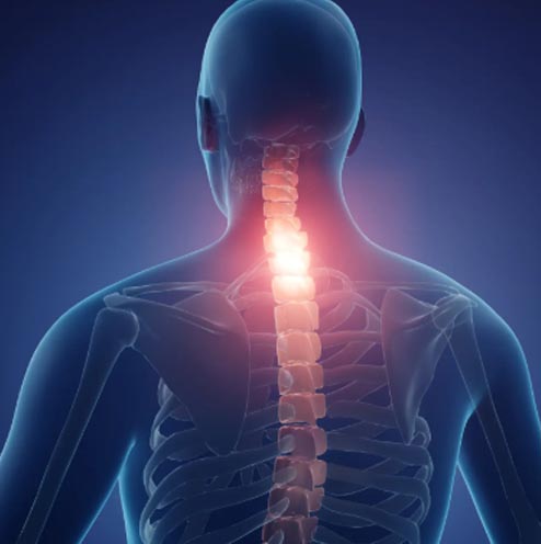Interventional Pain Management